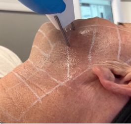 franklin medical spa patient receiving treatment